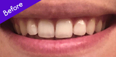 Teeth